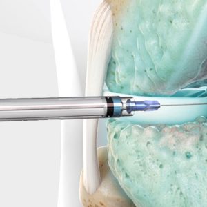 Dublin Certificate in Evidence Based Joint Injection 2026